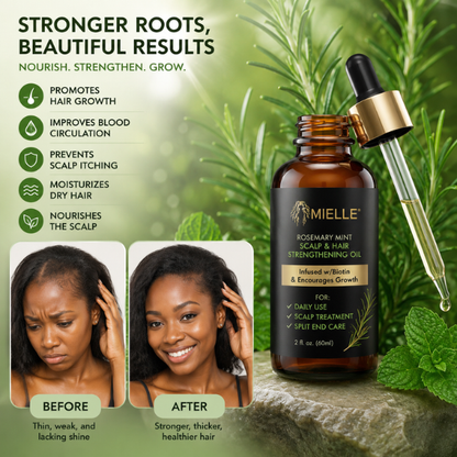 Givéra Rosemary Mint Oil™ – Root Nourishing Hair & Scalp Elixir